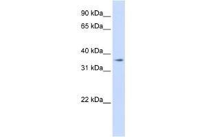 WB Suggested Anti-TMEM30B Antibody Titration:  0. (TMEM30B 抗体  (Middle Region))
