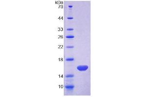 SDS-PAGE analysis of Human MARS Protein. (MARS 蛋白)