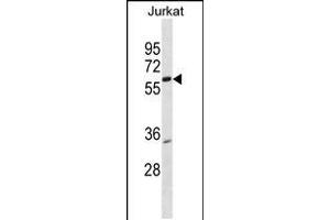 Western blot analysis in Jurkat cell line lysates (35ug/lane). (PKNOX2 抗体  (AA 298-324))