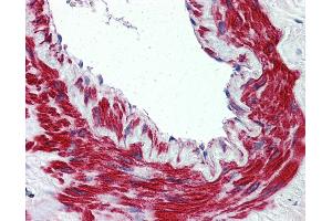 Immunohistochemistry (IHC) image for anti-Transient Receptor Potential Cation Channel, Subfamily M, Member 8 (TRPM8) (N-Term) antibody (ABIN960829)
