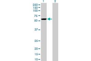 Western Blot analysis of YES1 expression in transfected 293T cell line by YES1 monoclonal antibody (M01), clone 2F4. (YES1 抗体  (AA 1-543))