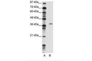 Image no. 1 for anti-Zinc Finger Protein 444 (ZNF444) (AA 251-300) antibody (ABIN202253) (ZNF444 抗体  (AA 251-300))