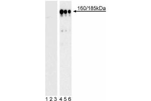Western blot analysis of IRS-1 (pY896) in transformed human epithelial cells. (IRS1 抗体  (pTyr896))