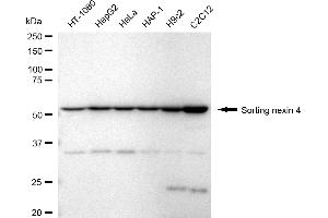Western blotting analysis using sorting nexin 4 antibody (ABIN7800409). (Recombinant Sorting Nexin 4 抗体)