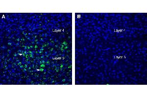 Expression of LRRTM2 in mouse parietal cortex. (LRRTM2 抗体  (Extracellular))