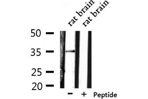 Western blot analysis of extracts from rat brain, using OR6N1 Antibody. (OR6N1 抗体)