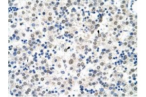 HSP90B1 antibody was used for immunohistochemistry at a concentration of 4-8 ug/ml to stain Hepatocytes (arrows) in Human Liver. (GRP94 抗体)