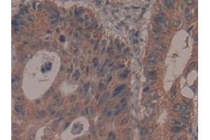 Immunohistochemistry (IHC) image for anti-Glycyl-tRNA Synthetase (GARS) (AA 567-735) antibody (ABIN7435301)