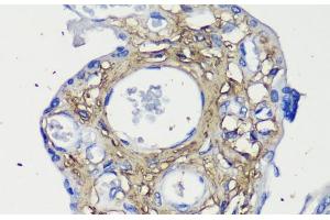 Immunohistochemistry of paraffin-embedded Human placenta using Decorin Polyclonal Antibody at dilution of 1:200 (40x lens). (Decorin 抗体)