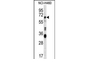 HERV-FRD Antibody (N-term) (ABIN656942 and ABIN2846131) western blot analysis in NCI- cell line lysates (35 μg/lane). (HERV-FRD Provirus Ancestral Env Polyprotein (Herv-frd) (AA 79-107), (N-Term) 抗体)