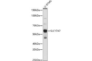 Western blot analysis of extracts of U-87MG cells, using SLC17 antibody (ABIN6127303, ABIN6147863, ABIN6147864 and ABIN6216671) at 1:1000 dilution. (SLC17A7 抗体  (AA 461-560))
