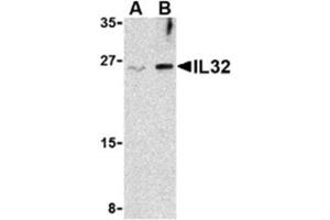 Image no. 1 for anti-Interleukin 32 (IL32) (Middle Region) antibody (ABIN318795) (IL32 抗体  (Middle Region))