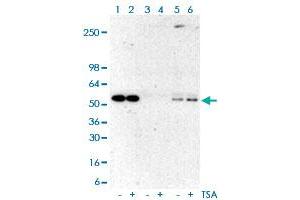 Immunoprecipitation analysis of Lane 1: A431 cell whole lysates, Lane 2: TSA-treated A431 cell whole lysates; Lane 3: A431 cell whole lysates, Lane 4: TSA-treated A431 cell whole lysates using rabbit IgG antibody; Lane 5: A431 cell whole lysates, Lane 6: TSA-treated A431 cell whole lysates using Acetylated-Lysine monoclonal antibody, clone RM101  at 1:500 dilution. (Acetylated Lysine 抗体  (acetylated))