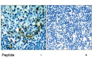 Image no. 1 for anti-zeta-Chain (TCR) Associated Protein Kinase 70kDa (ZAP70) (Tyr319) antibody (ABIN197384) (ZAP70 抗体  (Tyr319))