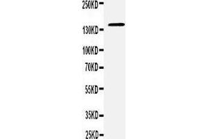 Anti-CD22 antibody,  Western blotting WB: RAJI Cell Lysate (CD22 抗体  (C-Term))