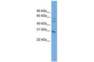 Image no. 1 for anti-mRNA Turnover 4 Homolog (MRTO4) (AA 143-192) antibody (ABIN6744820) (C1orf33 抗体  (AA 143-192))
