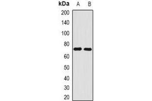 Western blot analysis of Angiomotin expression in A431 (A), M21 (B) whole cell lysates.