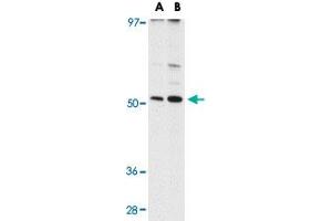 Western blot analysis of MATN3 in NIH/3T3 cell lysate with MATN3 polyclonal antibody  at (A) 1 and (B) 2 ug/mL . (Matrilin 3 抗体  (C-Term))