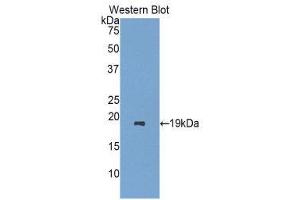 Western Blotting (WB) image for anti-Retinol Binding Protein 7, Cellular (RBP7) (AA 1-134) antibody (ABIN1860420) (RBP7 抗体  (AA 1-134))