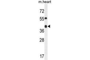 ADH4 Antibody (C-term) western blot analysis in mouse heart tissue lysates (35µg/lane). (ADH4 抗体  (C-Term))