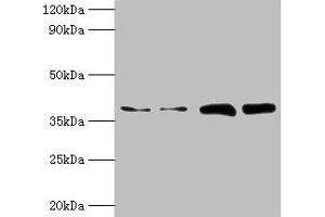Western blot All lanes: TBCC antibody at 2 μg/mL Lane 1: Hela whole cell lysate Lane 2: HepG2 whole cell lysate Lane 3: A549 whole cell lysate Lane 4: MCF-7 whole cell lysate Secondary Goat polyclonal to rabbit IgG at 1/10000 dilution Predicted band size: 40 kDa Observed band size: 40 kDa (TBCC 抗体  (AA 2-346))