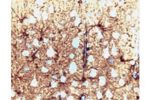 Glutamine synthetase staining on a rat cerebrum section. (GLN1 抗体  (AA 1-373))
