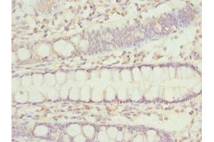 Immunohistochemistry of paraffin-embedded human colon tissue using ABIN7156305 at dilution of 1:100 (IP6K2 抗体  (AA 1-180))