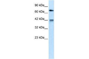 WB Suggested Anti-CACNB1 Antibody Titration:  0. (CACNB1 抗体  (N-Term))