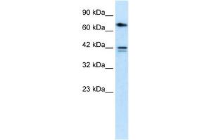 WB Suggested Anti-CACNB1 Antibody Titration:  0.