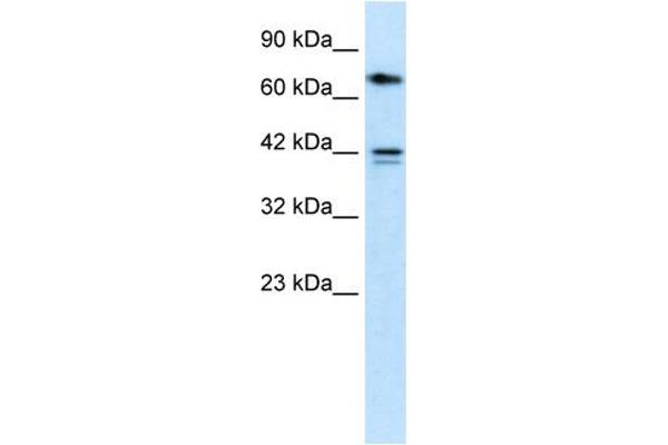 CACNB1 anticorps  (N-Term)