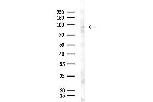 anti-Breast Cancer Anti-Estrogen Resistance 3 (BCAR3) (C-Term) antibody