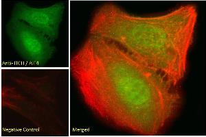 ABIN334426 Immunofluorescence analysis of paraformaldehyde fixed U2OS cells, permeabilized with 0. (ITCH 抗体  (Internal Region))