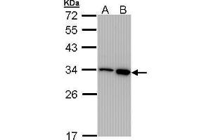 WB Image Sample (30 ug of whole cell lysate) A: 293T B: A431 , 12% SDS PAGE antibody diluted at 1:1000 (RPA2 抗体)