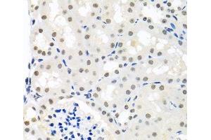 Immunohistochemistry of paraffin-embedded Mouse kidney using THOC1 Polyclonal Antibody at dilution of 1:100 (40x lens). (THOC1 抗体)