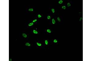 Immunofluorescent analysis of Hela cells using ABIN7139610 at dilution of 1:100 and Alexa Fluor 488-congugated AffiniPure Goat Anti-Rabbit IgG(H+L) (HIST1H3A 抗体  (meLys9))