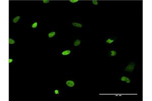 Immunofluorescence of monoclonal antibody to MCM6 on HeLa cell.