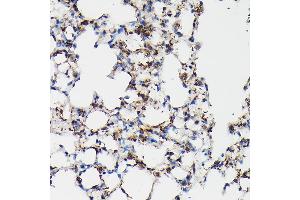 Immunohistochemistry of paraffin-embedded mouse lung using SFTP Rabbit pAb (ABIN3017436, ABIN3017437, ABIN3017438 and ABIN6220091) at dilution of 1:50 (40x lens). (Surfactant Protein A1 抗体)