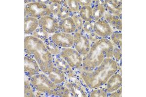 Immunohistochemistry of paraffin-embedded mouse kidney using NLRC4 antibody (ABIN5975127) at dilution of 1/100 (40x lens). (NLRC4 抗体)
