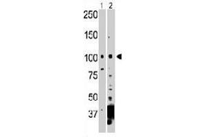 The NEK9 polyclonal antibody  is used in Western blot to detect NEK9 in 293 cell lysate (Lane 1) and mouse heart tissue lysate (Lane 2) . (NEK9 抗体  (C-Term))