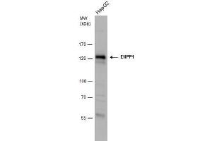 WB Image ENPP1 antibody detects ENPP1 protein by western blot analysis. (ENPP1 抗体)