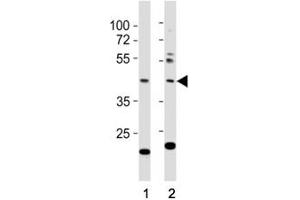 Western blot testing of E2F1 antibody at 1:1000 dilution. (E2F1 抗体  (AA 342-371))