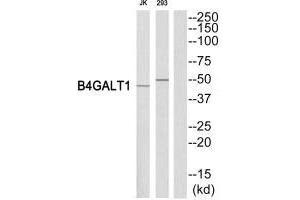 Western blot analysis of extracts from Jurkat/293 cells, using B4GALT1 antibody. (B4GALT1 抗体  (C-Term))