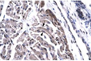 Rabbit Anti-TAF 15 Antibody  Paraffin Embedded Tissue: Human Skeletal Muscle Cellular Data: Skeletal muscle cells Antibody Concentration: 4.