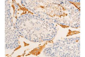 ABIN6267219 at 1/100 staining mouse testis tissue sections by IHC-P.