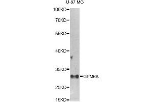 Western blot analysis of extracts of U-87MG cells, using GPM6A antibody. (GPM6A 抗体)
