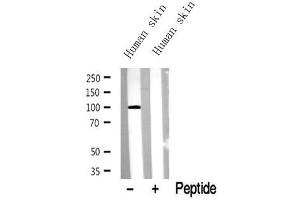 Western blot analysis of extracts of Human skin? (TRPV1 抗体  (C-Term))