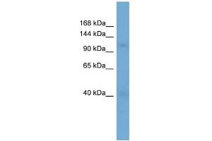 WB Suggested Anti-RANBP5 Antibody Titration: 0. (Importin 5 抗体  (N-Term))