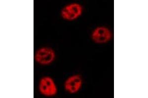 ABIN6277140 staining  HuvEc cells by IF/ICC. (ALOX5 抗体  (C-Term))