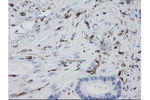 Image no. 1 for anti-Coagulation Factor XIII, A1 Polypeptide (F13A1) antibody (ABIN1498146) (F13A1 抗体)