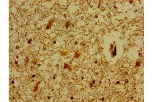 Immunohistochemistry of paraffin-embedded human brain tissue using ABIN7159217 at dilution of 1:100 (MC5 Receptor 抗体  (AA 1-37))